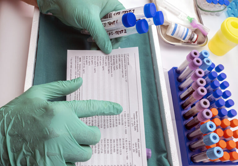 Scientific analyzes results of cerebrospinal fluid in patients